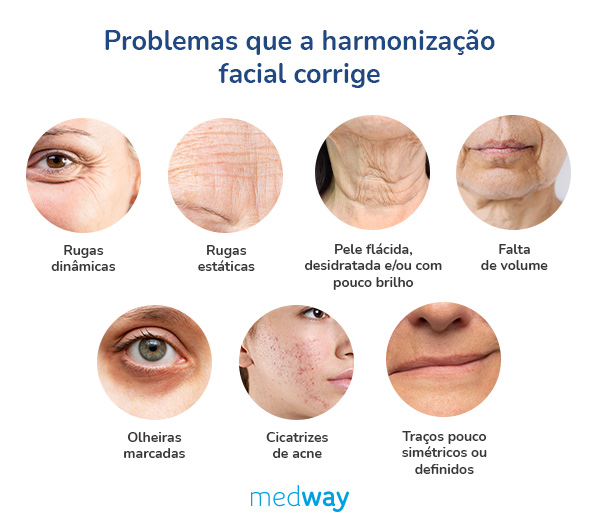 procedimentos-harmonização-facial