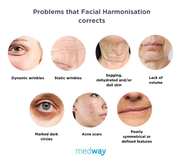 Problems-that-Facial-Harmonisation-corrects